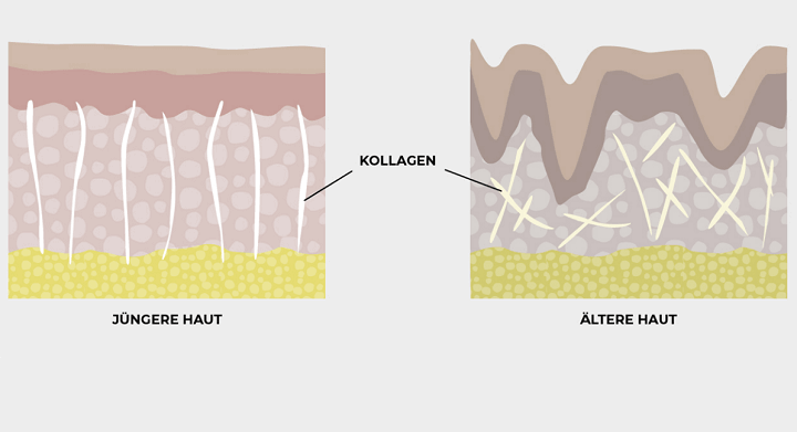 Kollagen: jüngere Haut vs. ältere Haut